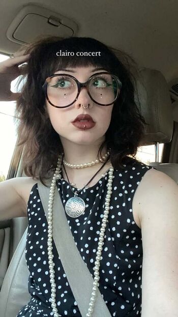 smallwoundedfawn